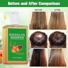 🍂SHAMPOO BATANA 🍂